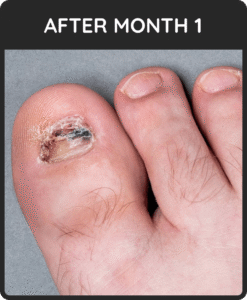 nails after one month